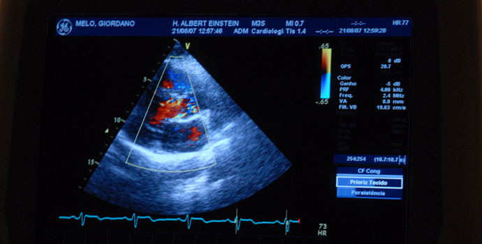 Exame ecocardiograma