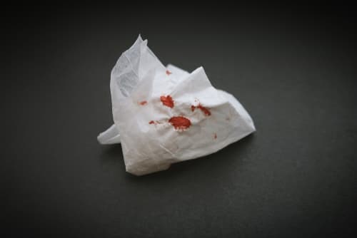 Foto de papel amassado com marcas de sangue após um episódio de tosse.