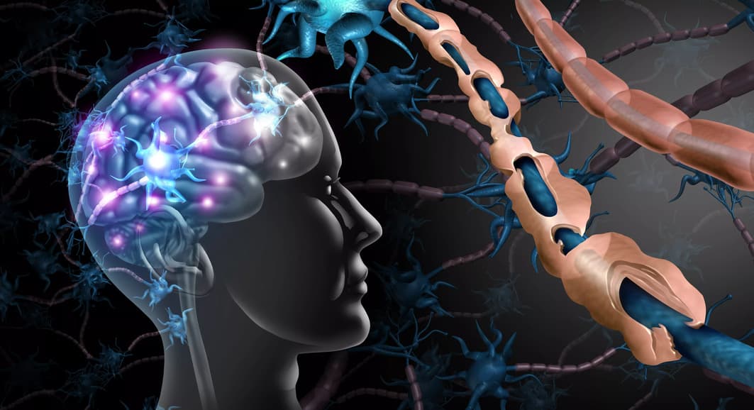 Imagem em 3D de um cérebro humano, ilustrando as conexões cerebrais