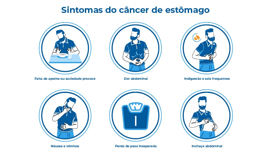 Ilustração apresenta seis figuras que demonstram os sintomas do câncer de estômago: falta de apetite ou saciedade precoce, dor abdominal, indigestão e azia frequentes, náusea e vômitos, perda de peso inesperada e inchaço abdominal