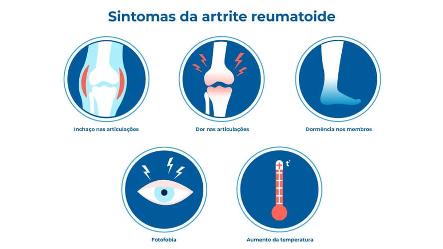 O infográfico sobre artrite reumatoide destaca seus sintomas como inchaço e dor nas articulações, dormência nos membros, fotofobia e aumento da temperatura. Ícones acompanham para mostrar onde os sintomas se instalam ou como podem ser comprovados.