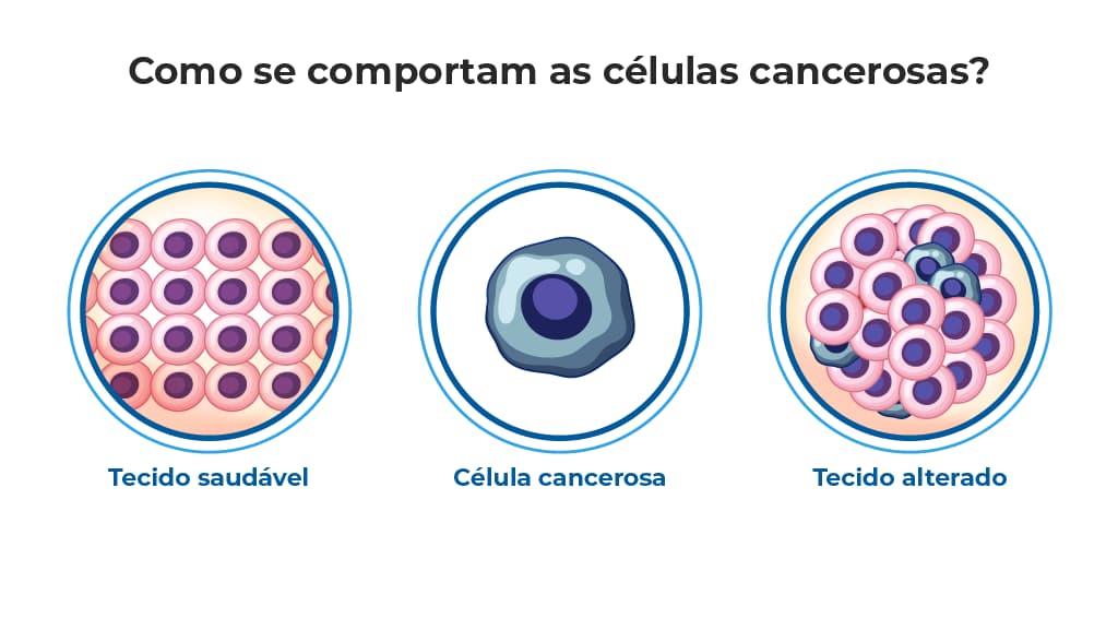 Imagem com três diagramas. O primeiro é intitulado Tecido saudável e mostra células organizadas. O segundo, Célula cancerosa, exibe uma célula anormal. O terceiro, Tecido alterado, mostra um aglomerado de células desordenadas.