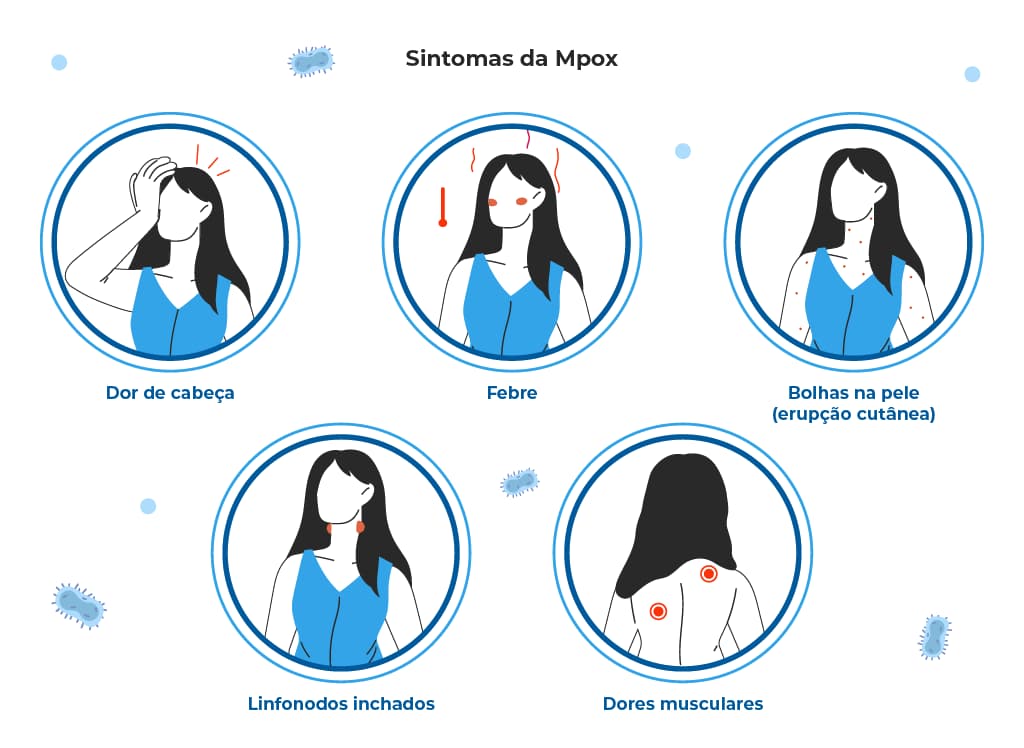 A imagem mostra uma ilustração de uma mulher que apresenta diversos sintomas da mpox como febre, dor de cabeça, ínguas ou linfonodos inchados, bolhas na pele ou erupção cutânea, dor nas costas, e dor muscular