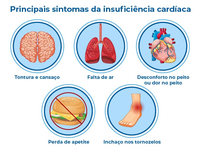 Infográfico com cinco imagens que ajudam a explicar os principais sintomas da insuficiência cardíaca: tontura, fadiga, falta de ar, dor no peito, perda de apetite e inchaço nos tornozelos