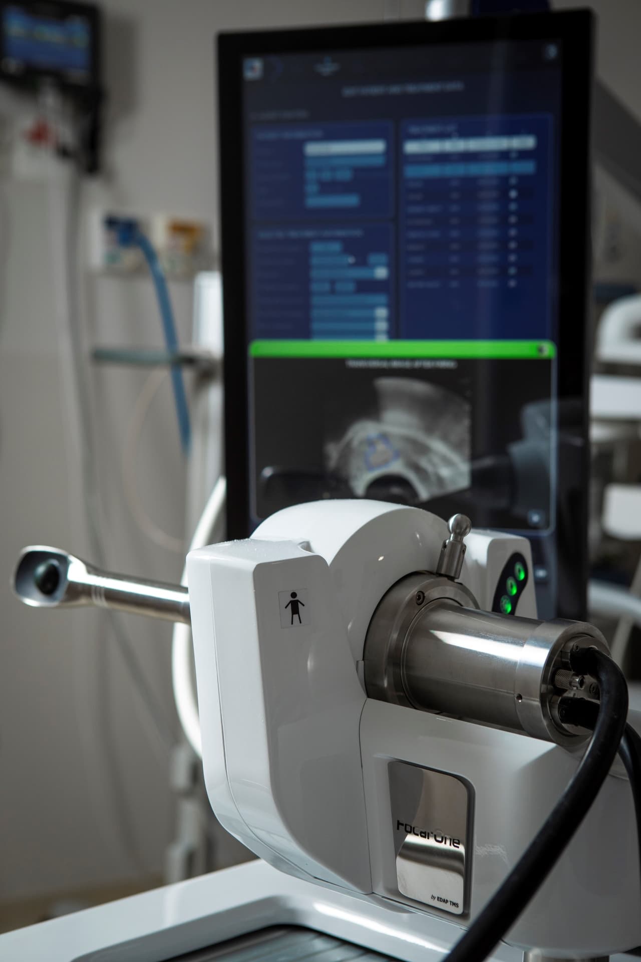 HITHOC, que combina cirurgia robótica e quimioterapia aquecida para tratar tumores pleurais complexos.