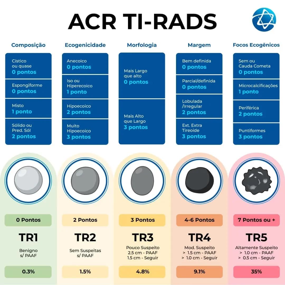 A imagem apresenta informações sobre o TI-RADS, que é utilizado para a interpretação dos resultados de ultrassonografias da tireoide. Por meio dele, é possível avaliar se um nódulo é benigno ou se há suspeita de malignidade. As informações contemplam a composição, ecogenicidade, morfologia, margens e focos ecogênicos, além da classificação que varia de TR1 a TR5.
