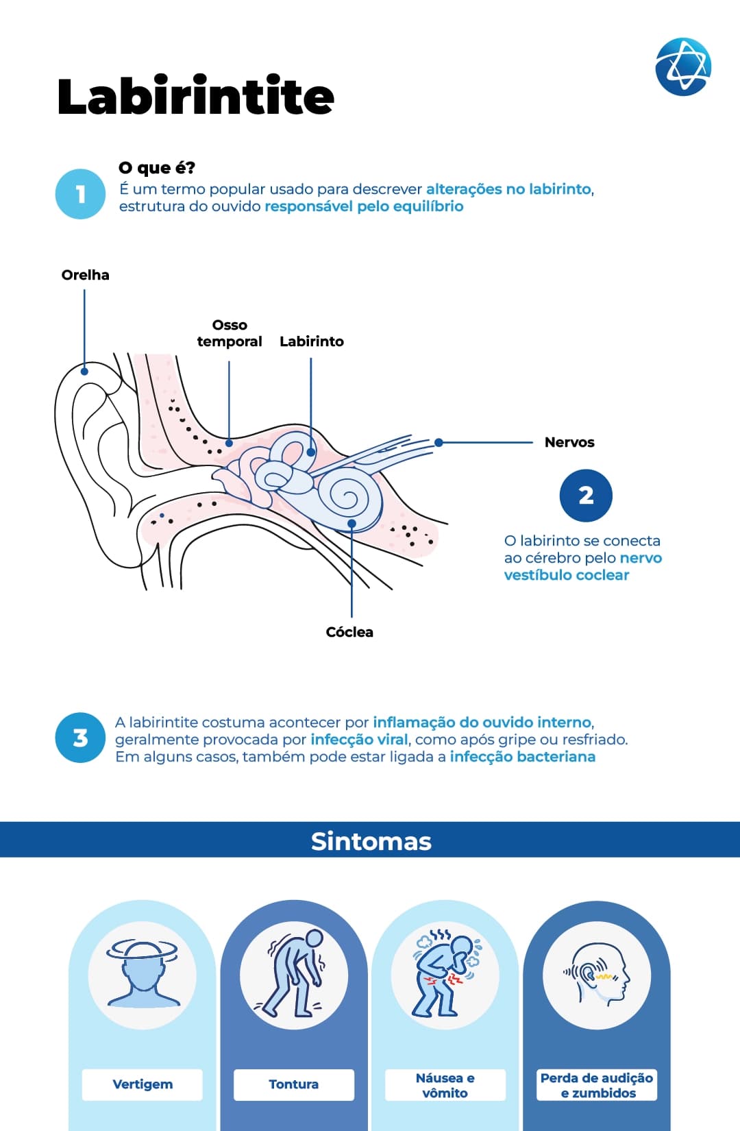 Labirintite: Diagrama anatômico do ouvido interno explicando a inflamação do labirinto e listando sintomas como vertigem, tontura e perda de audição.