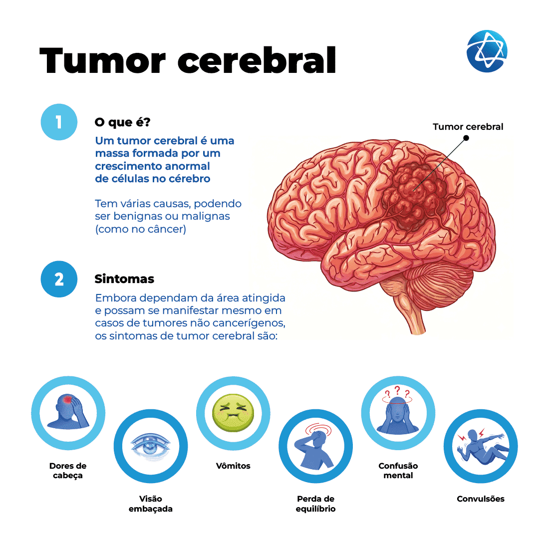 Infográfico sobre tumor cerebral, definido como uma massa causada pelo crescimento anormal de células no cérebro. Mostra a localização do tumor em ilustração do órgão e explica que pode ser benigno ou maligno. Destaca sintomas como dores de cabeça, visão embaçada, vômitos, perda de equilíbrio, confusão mental e convulsões.