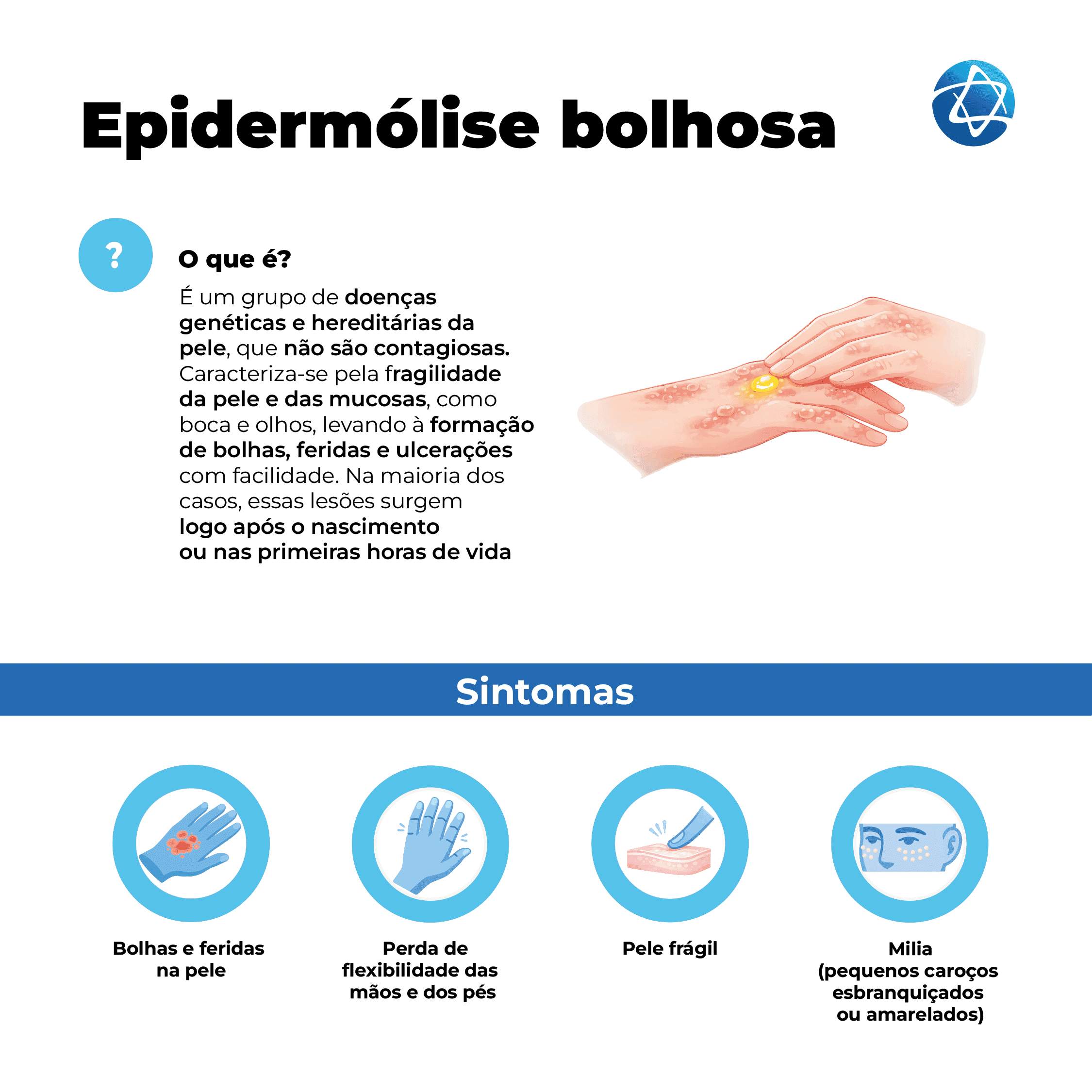 Infográfico sobre epidermólise bolhosa, condição da "criança borboleta". definida como doença genética não contagiosa que causa fragilidade extrema na pele e mucosas, gerando bolhas e feridas ao toque. A ilustração mostra o contato entre duas mãos com lesões e áreas sensíveis. Entre os sintomas listados estão: pele frágil, ulcerações, perda de flexibilidade e milia, descrita como pequenos caroços esbranquiçados ou amarelados.