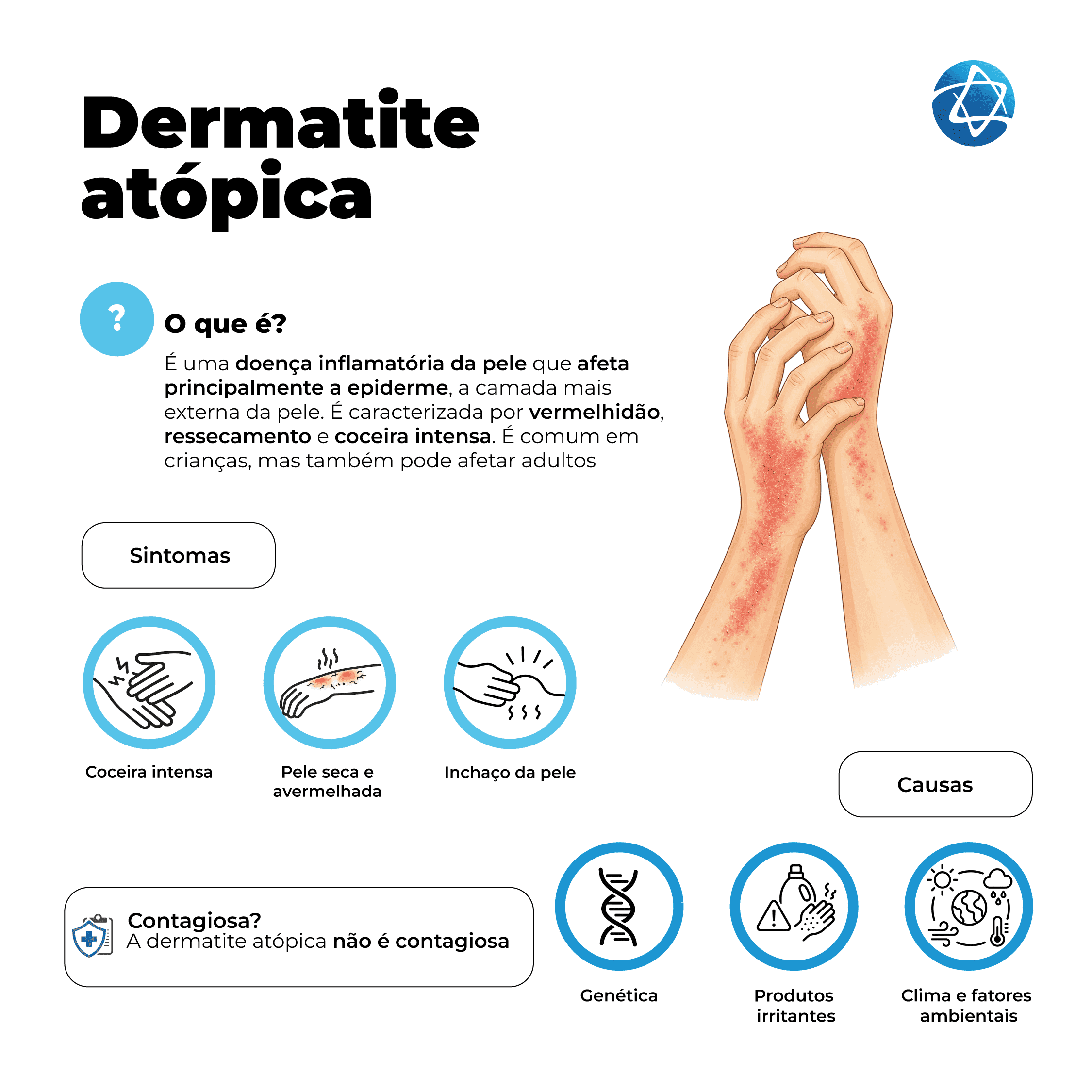 Infográfico sobre dermatite atópica, comumente conhecida como eczema ou eczema atópico, explicando que é uma doença inflamatória da pele que afeta principalmente a epiderme, causando vermelhidão, ressecamento e coceira intensa. Mostra sintomas como coceira intensa, pele seca e avermelhada e inchaço da pele. Também apresenta causas como genética, produtos irritantes e fatores climáticos e ambientais, além de informar que a dermatite atópica não é contagiosa.