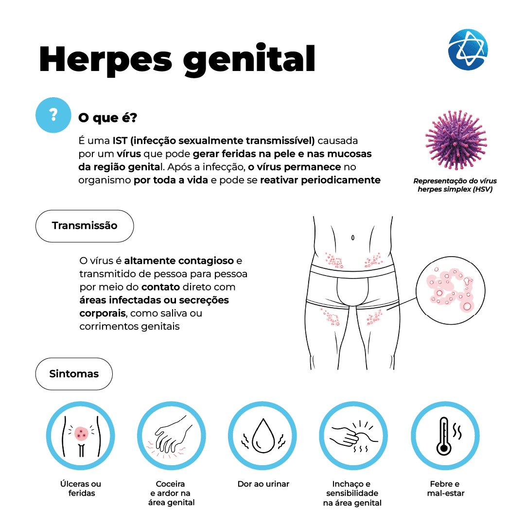 Infográfico exibe representação ilustrativa do vírus e explica que a herpes genial é uma IST causada por vírus que permanece no organismo por toda a vida e pode gerar feridas na pele e mucosas da região genital. As formas de transmissão são por contato direto e os principais sintomas são: coceira, dor ao urinar, inchaço e febre.