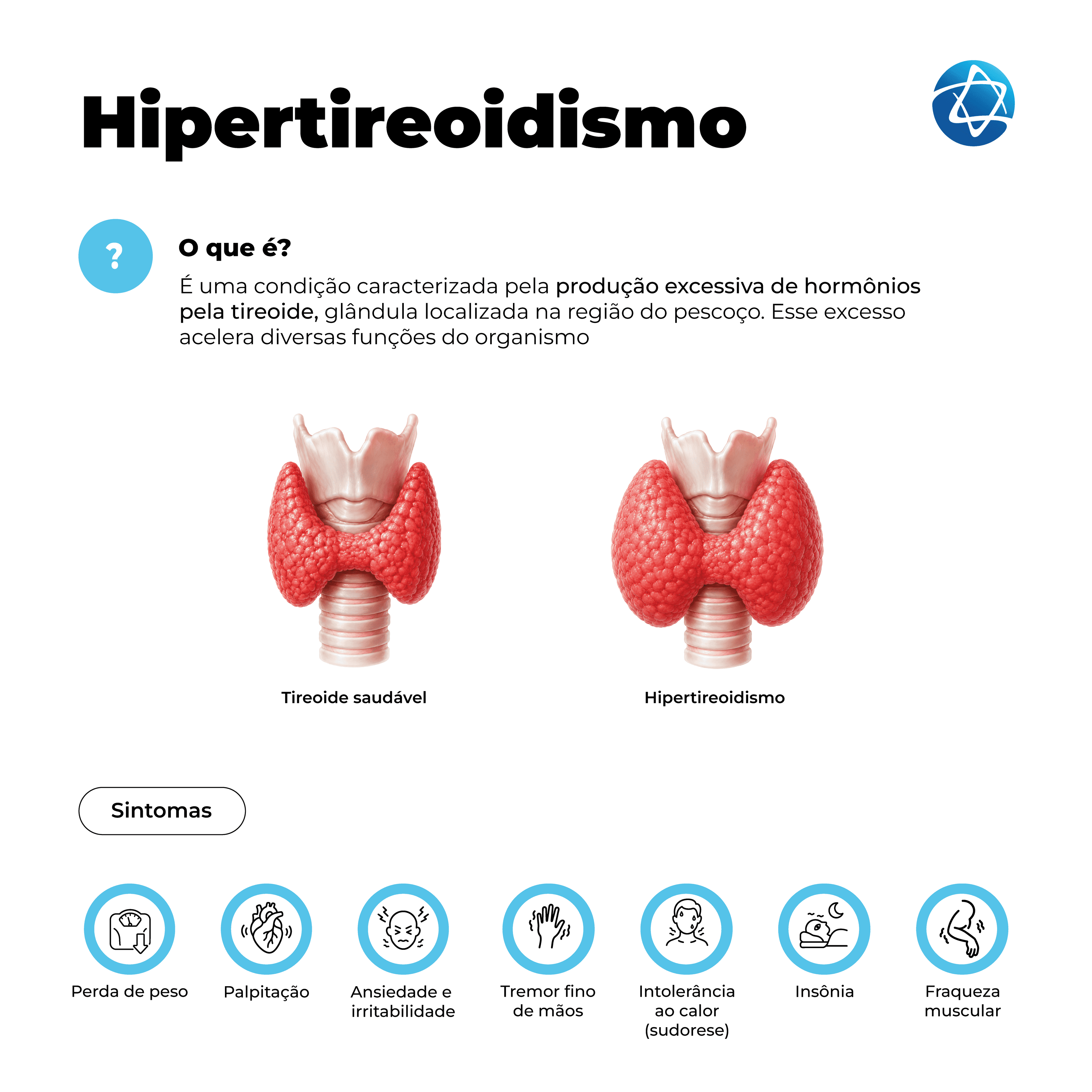 Infográfico sobre hipertireoidismo explicando que a condição ocorre pela produção excessiva de hormônios pela tireoide, acelerando funções do organismo. Compara tireoide saudável e tireoide com hipertireoidismo, além de sintomas como perda de peso, palpitação, ansiedade, irritabilidade, tremor nas mãos, intolerância ao calor, insônia e fraqueza muscular.