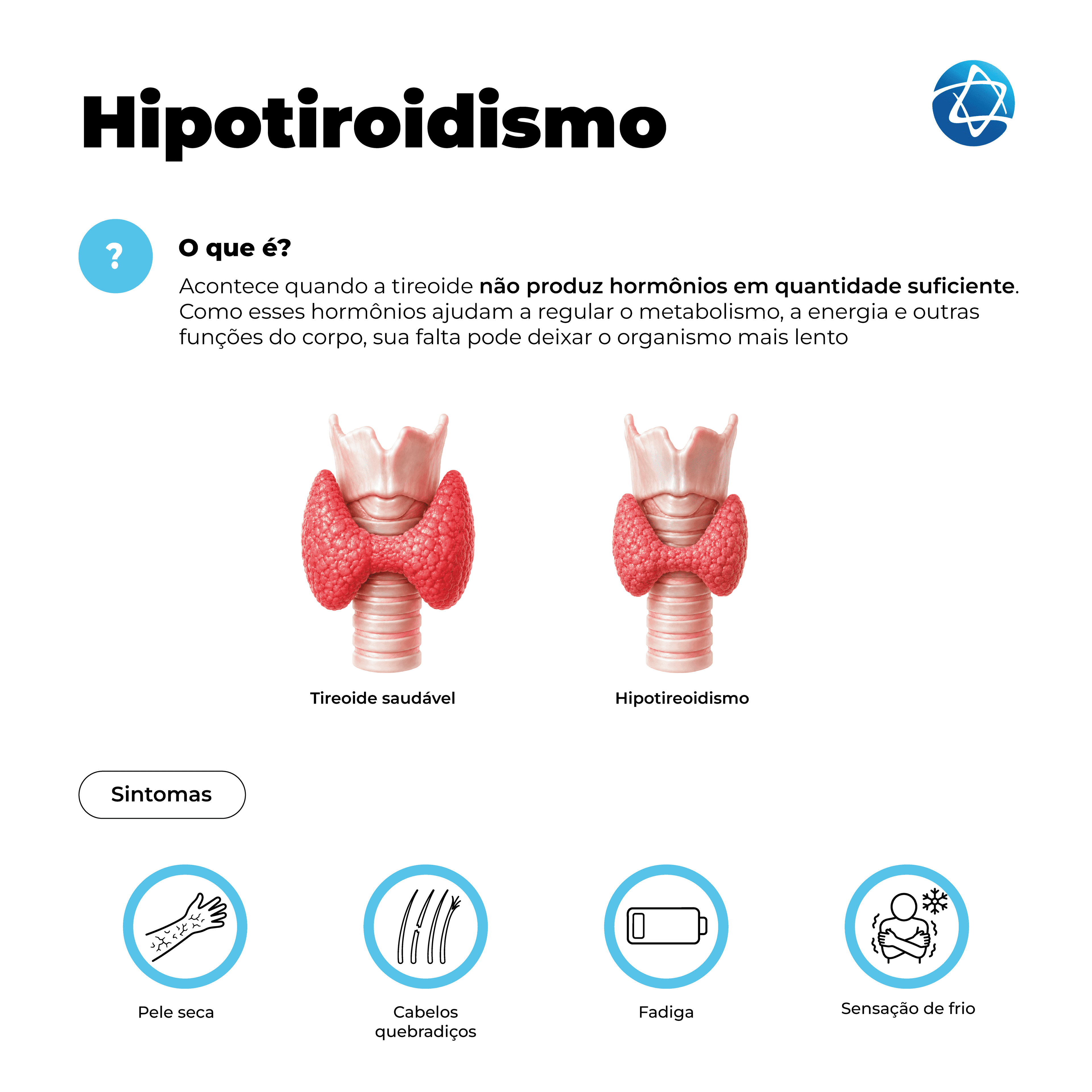 Infográfico sobre hipotireoidismo explicando que a condição ocorre quando a tireoide não produz hormônios em quantidade suficiente, deixando o metabolismo e outras funções do corpo mais lentos. Compara tireoide saudável e tireoide com hipotireoidismo, além de sintomas como pele seca, cabelos quebradiços, fadiga e sensação de frio.