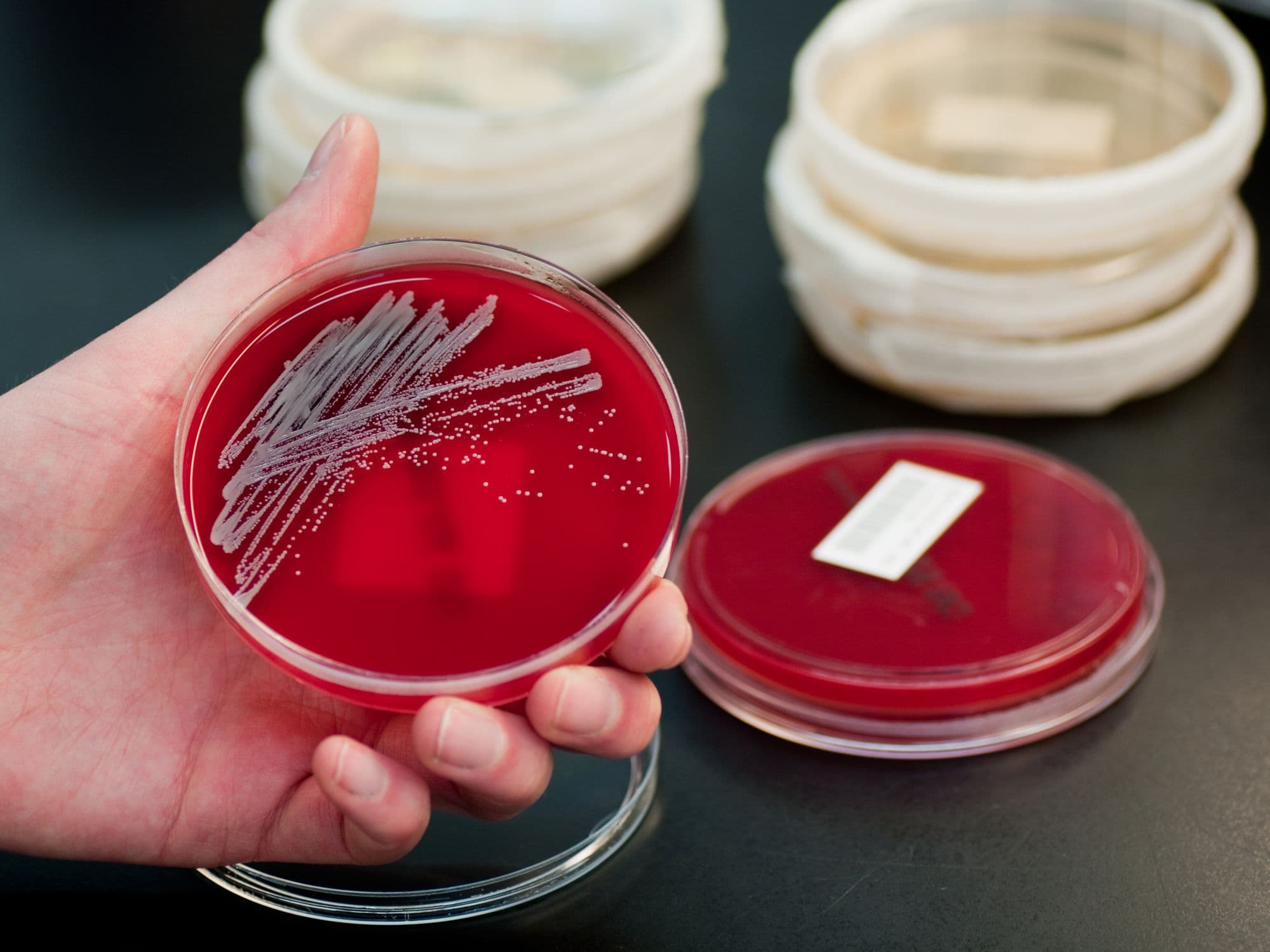 Staphylococcus aureus