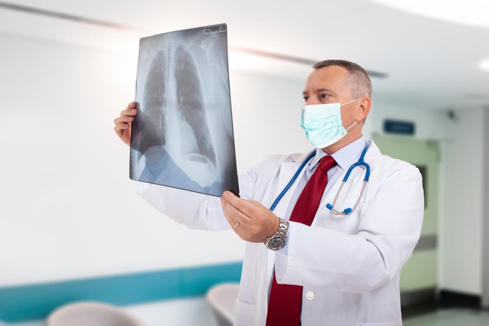 Doctor,Wearing,A,Mask,While,Holding,A,Lung,Radiography,,Coronavirus
