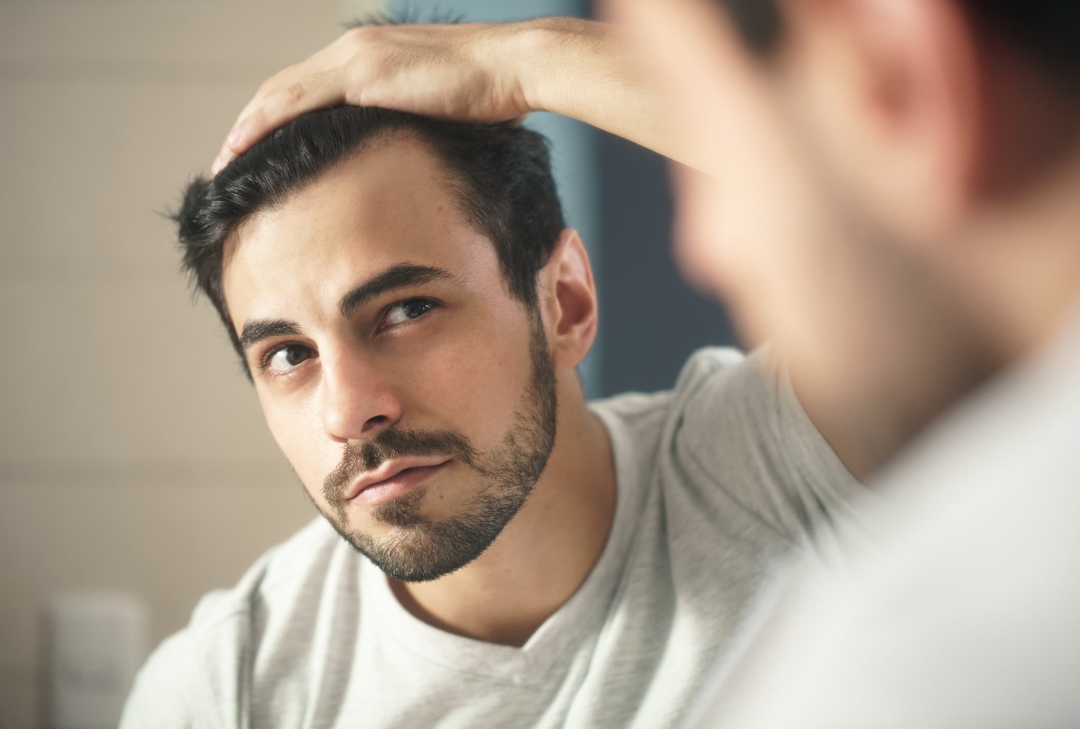 calvície masculina