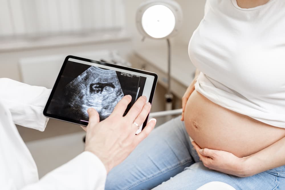 Doctor,With,An,Ultrasound,Scan,Of,Unborn,Child,On,A