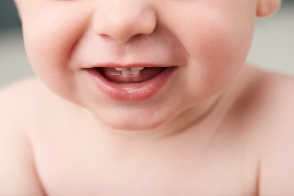 dentes