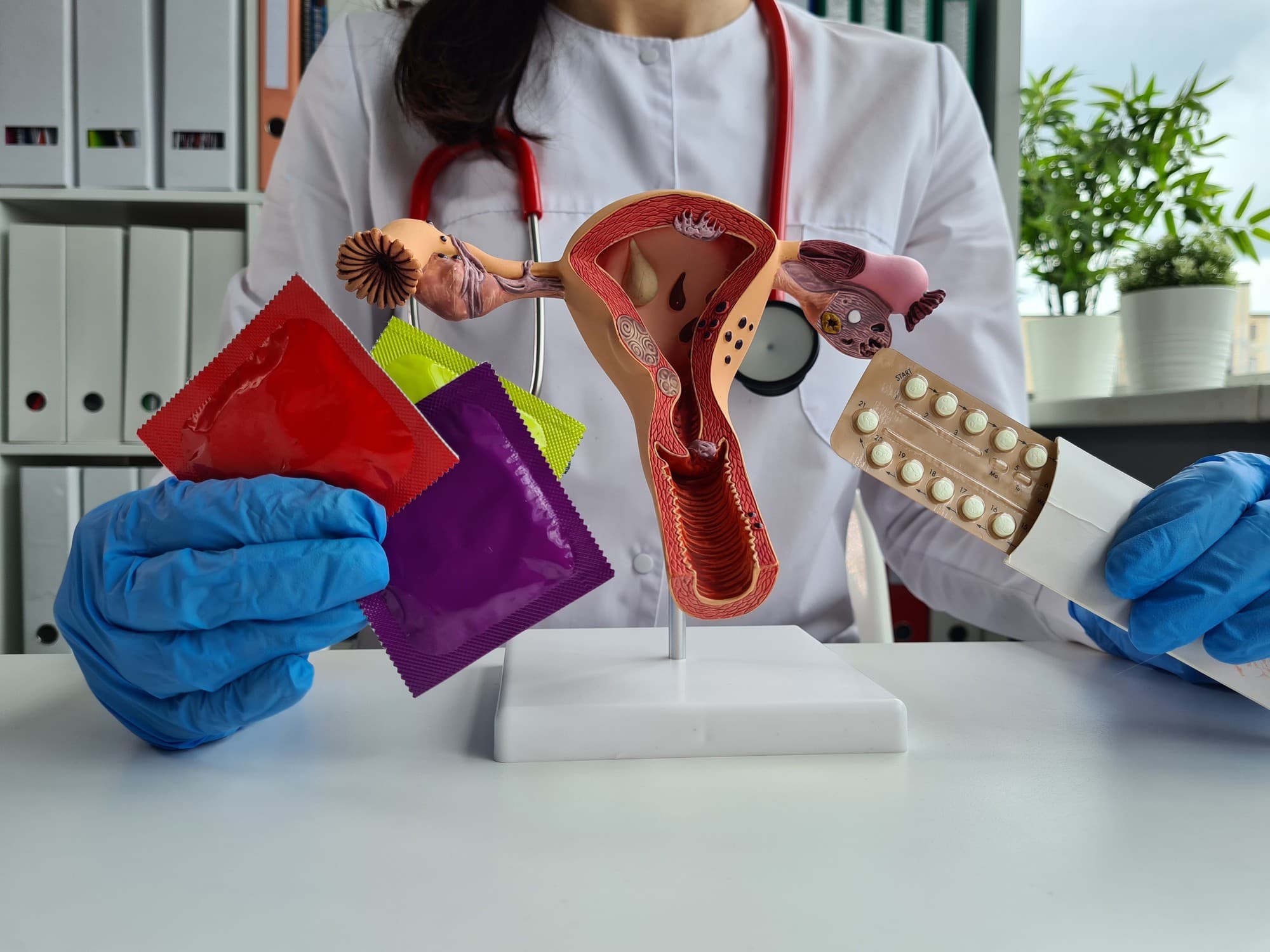 métodos contraceptivos