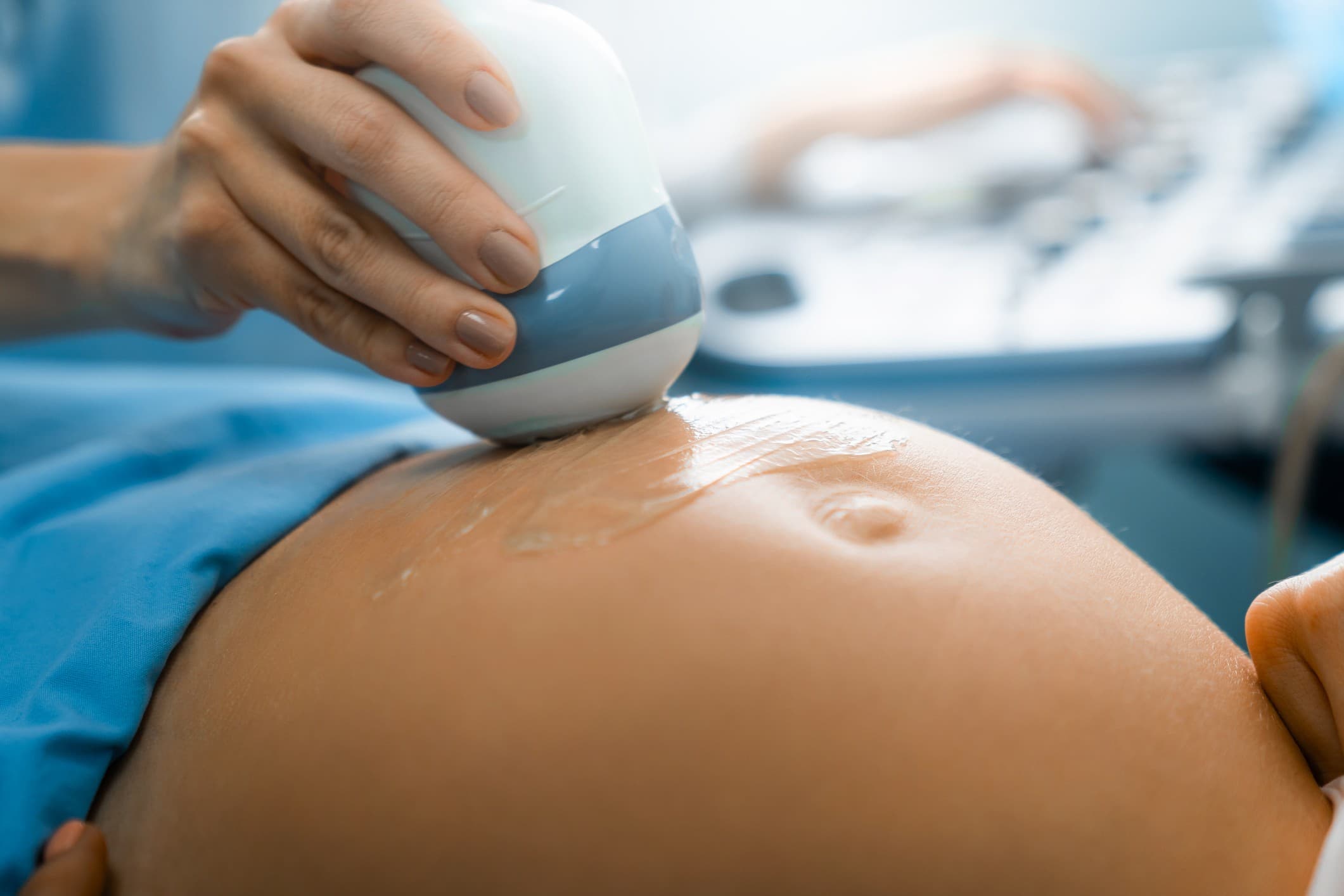 placenta prévia