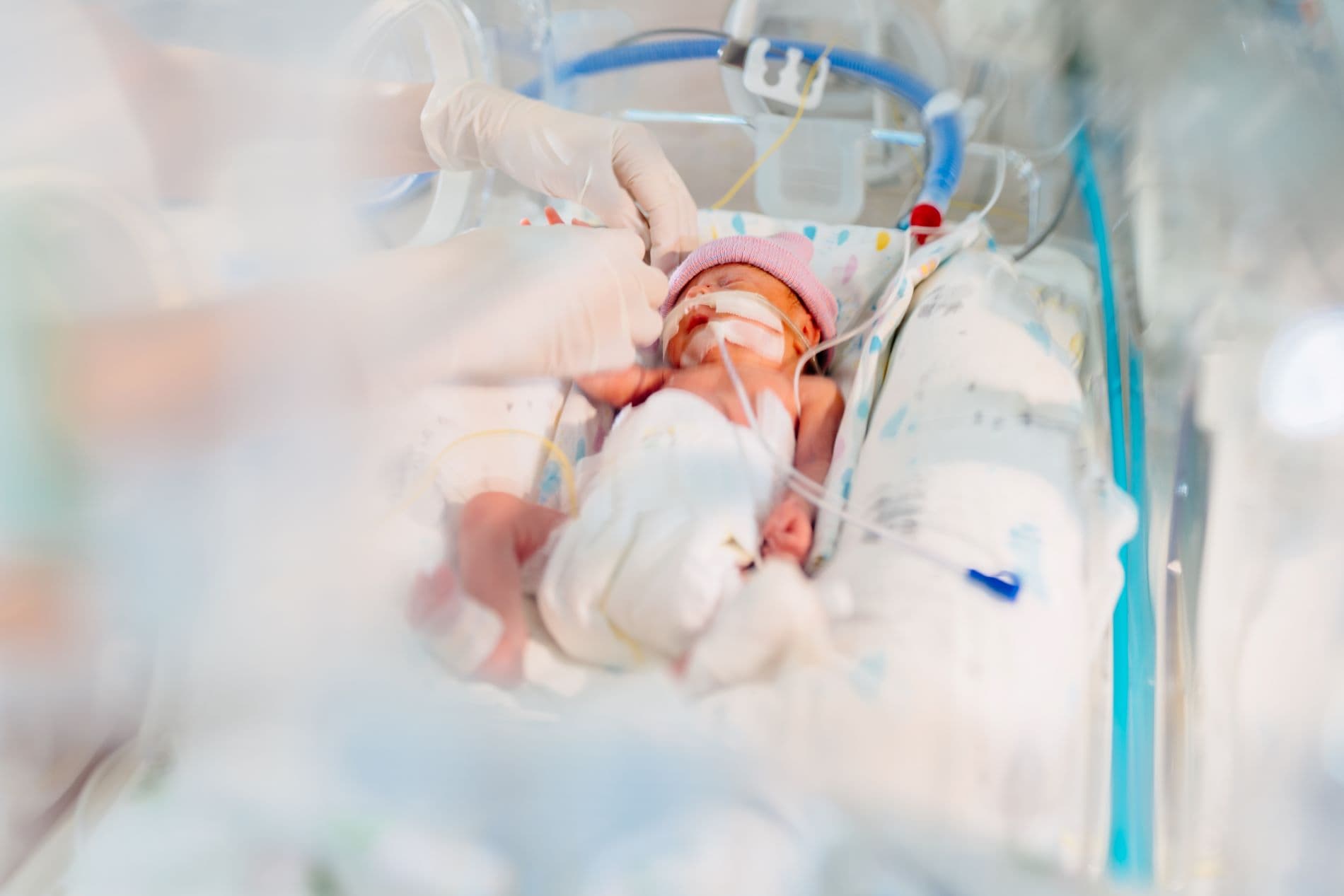 sepse neonatal