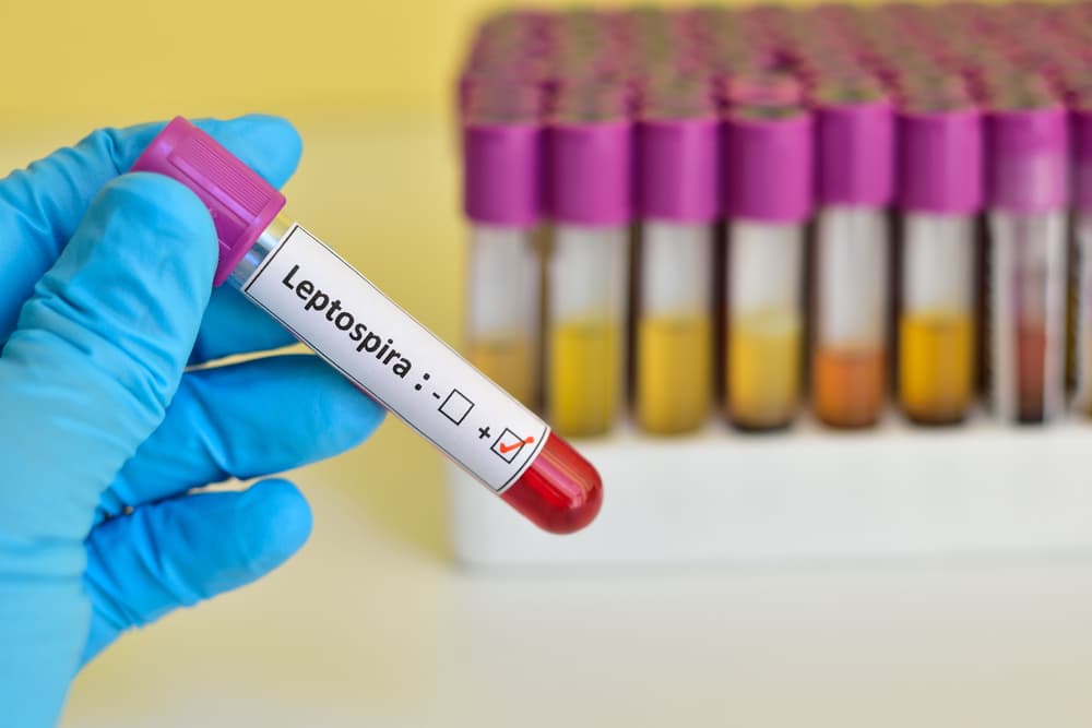 Blood,Sample,Positive,With,Leptospira,Bacteria