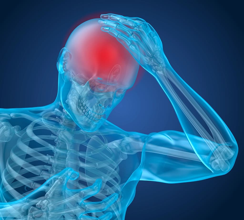 Ilustração 3D de esqueleto humano com a mão na cabeça, em destaque seu crânio, que representa a dor, um dos sintomas da concussão cerebral Ilustração 3D de esqueleto humano com a mão na cabeça, em destaque seu crânio, que representa a dor, um dos sintomas da concussão cerebral