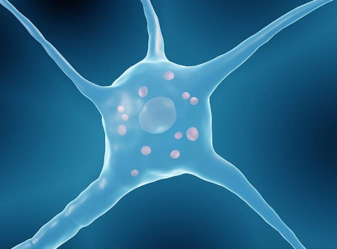 Neurona azul asociada al Parkinson. Neurona azul asociada al Parkinson.