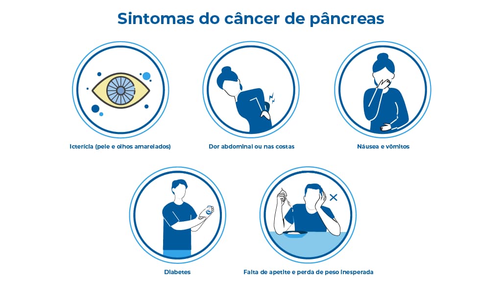 A imagem apresenta, por meio de cinco ícones, os sintomas do câncer de pâncreas, tais como: icterícia, que resulta na cor amarelada da pele e dos olhos, dor nas costas e abdominal, náuseas e vômitos, diabetes, perda de peso repentina e falta de apetite" A imagem apresenta, por meio de cinco ícones, os sintomas do câncer de pâncreas, tais como: icterícia, que resulta na cor amarelada da pele e dos olhos, dor nas costas e abdominal, náuseas e vômitos, diabetes, perda de peso repentina e falta de apetite"