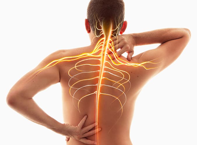 Imagem ilustrativa de hérnia de disco na coluna vertebral, destacando a região cervical e lombar Imagem ilustrativa de hérnia de disco na coluna vertebral, destacando a região cervical e lombar