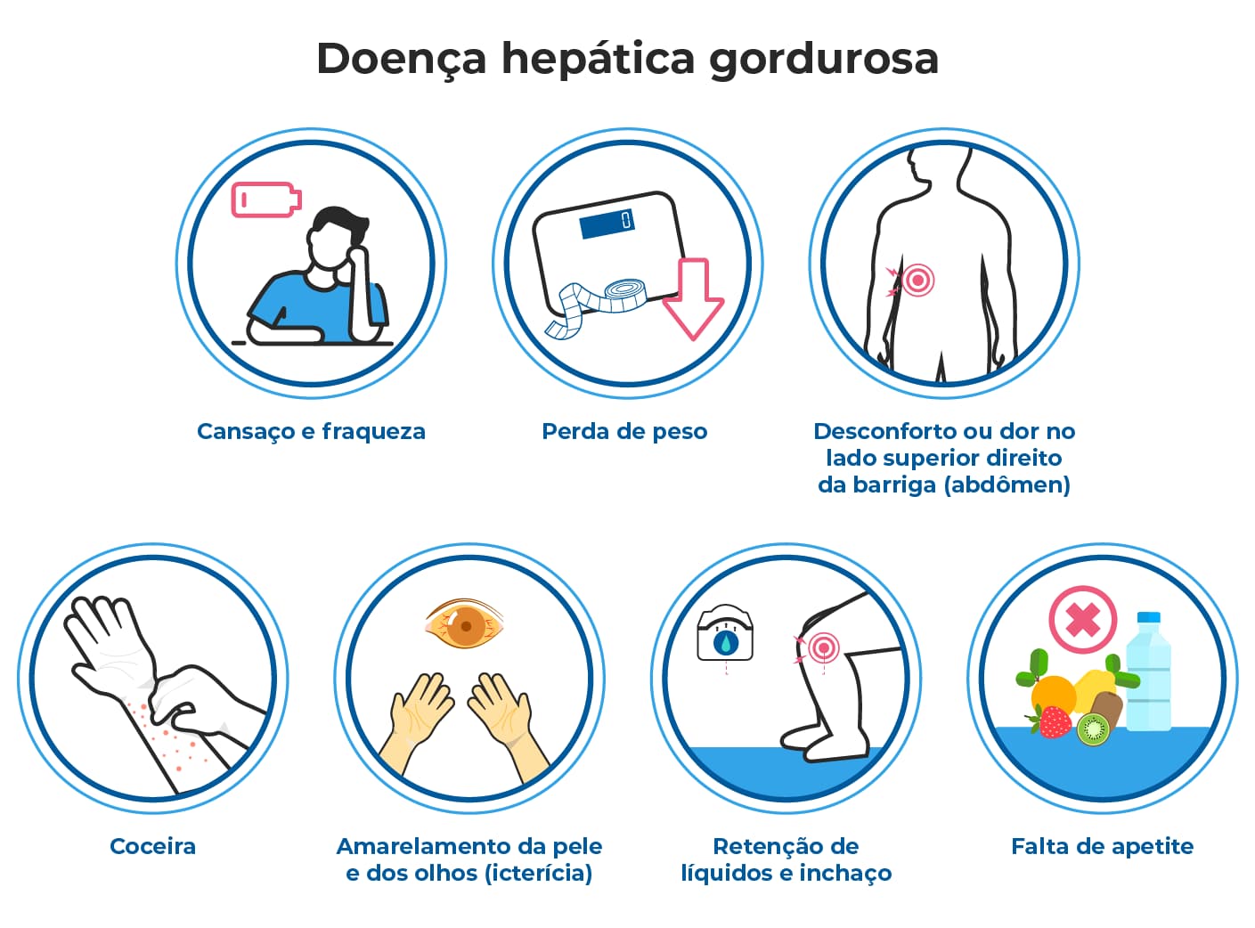 Ilustração mostra sintomas da esteatose hepática, como cansaço, perda de peso, dor abdominal, icterícia, relacionada à gordura no fígado, diabetes e obesidade. Ilustração mostra sintomas da esteatose hepática, como cansaço, perda de peso, dor abdominal, icterícia, relacionada à gordura no fígado, diabetes e obesidade.