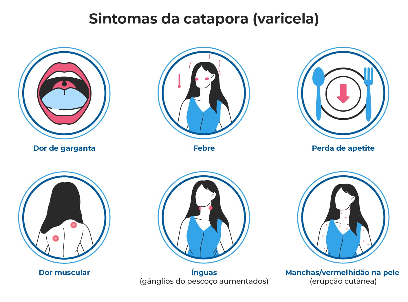 A ilustração mostra seis imagens que representam os sintomas da catapora (varicela): febre, dor de garganta, perda de apetite, ínguas, dor muscular e erupções vermelhas na pele. A ilustração mostra seis imagens que representam os sintomas da catapora (varicela): febre, dor de garganta, perda de apetite, ínguas, dor muscular e erupções vermelhas na pele.