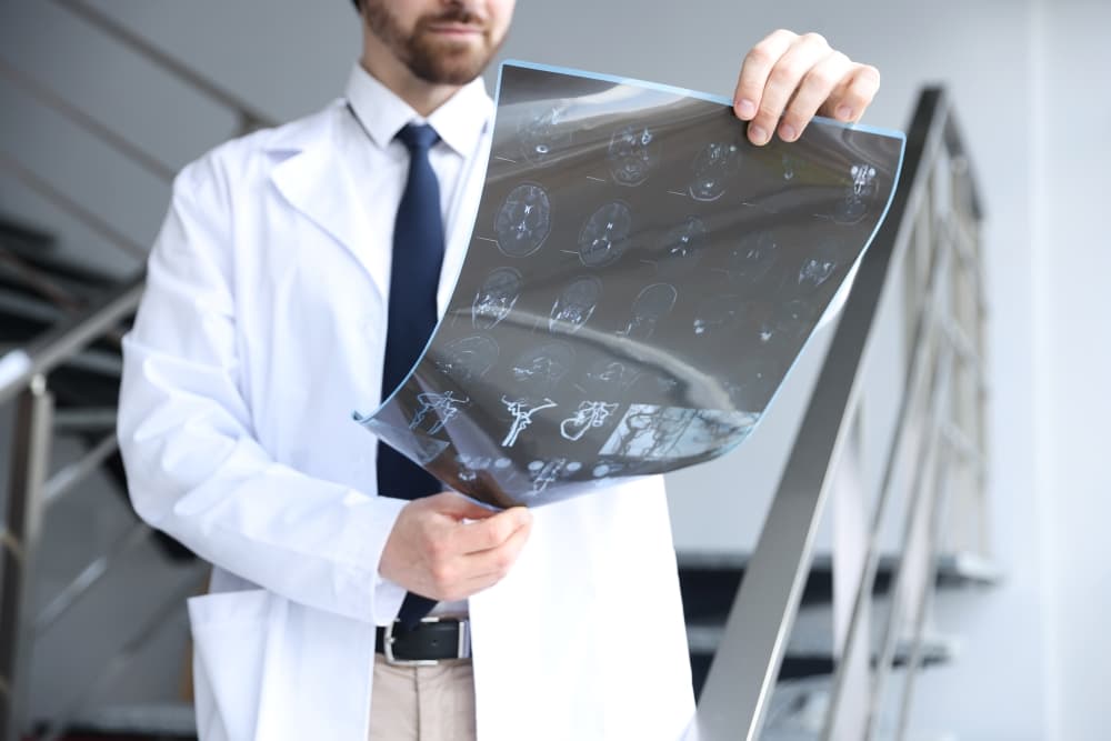 Um médico especialista em neurologia com um exame de imagem para diagnóstico de Alzheimer