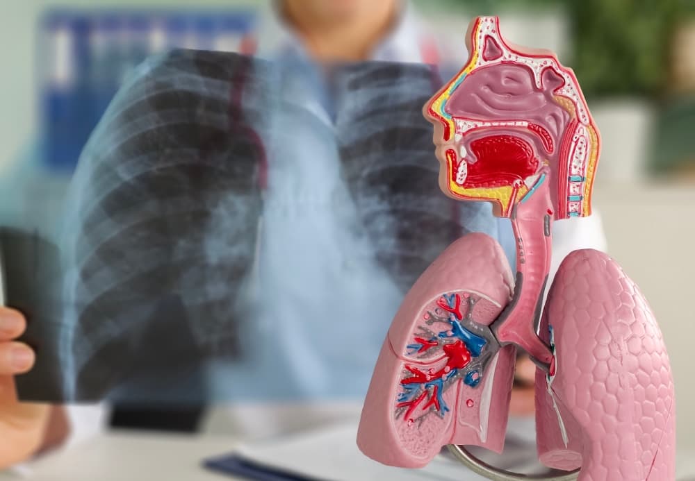 Maquete do sistema respiratório em primeiro plano, e um profissional de saúde avaliando um raio x dos pulmões