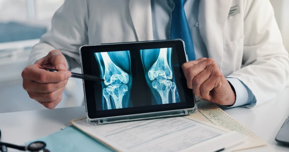 Um profissional médico explicando um exame de imagem dos joelhos devido aos sintomas de câncer nos ossos.