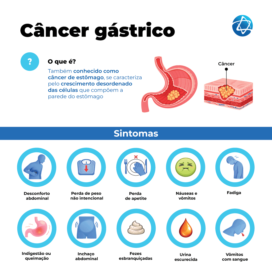Infográfico sobre câncer gástrico (câncer de estômago) com explicação e sintomas mais comuns. A imagem define a doença como o crescimento desordenado das células que compõem a parede do estômago e ilustra o órgão com a presença de um tumor. Também apresenta os principais sintomas: desconforto abdominal, perda de peso não intencional, perda de apetite, náuseas e vômitos, fadiga, indigestão ou queimação, inchaço abdominal, fezes esbranquiçadas, urina escurecida e vômitos com sangue. Infográfico sobre câncer gástrico (câncer de estômago) com explicação e sintomas mais comuns. A imagem define a doença como o crescimento desordenado das células que compõem a parede do estômago e ilustra o órgão com a presença de um tumor. Também apresenta os principais sintomas: desconforto abdominal, perda de peso não intencional, perda de apetite, náuseas e vômitos, fadiga, indigestão ou queimação, inchaço abdominal, fezes esbranquiçadas, urina escurecida e vômitos com sangue.