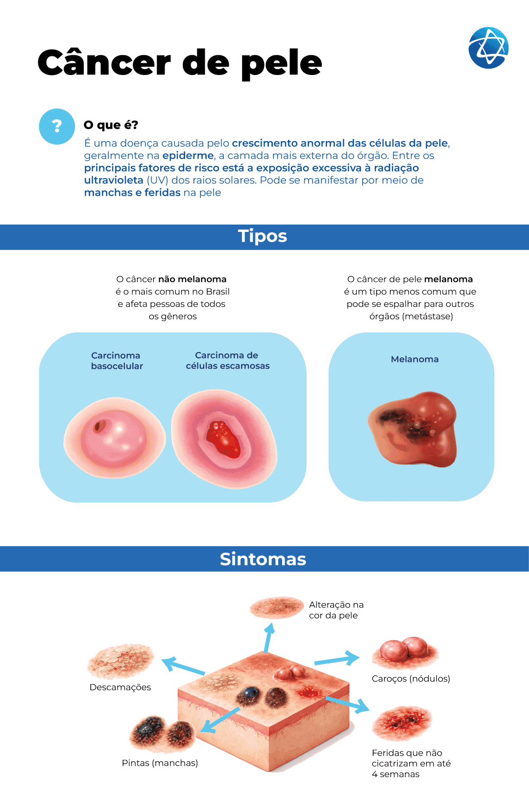 Infográfico sobre câncer de pele explicando causas, tipos como carcinoma basocelular, carcinoma de células escamosas e melanoma, além de sintomas como manchas, feridas que não cicatrizam, nódulos e alterações na pele. Infográfico sobre câncer de pele explicando causas, tipos como carcinoma basocelular, carcinoma de células escamosas e melanoma, além de sintomas como manchas, feridas que não cicatrizam, nódulos e alterações na pele.