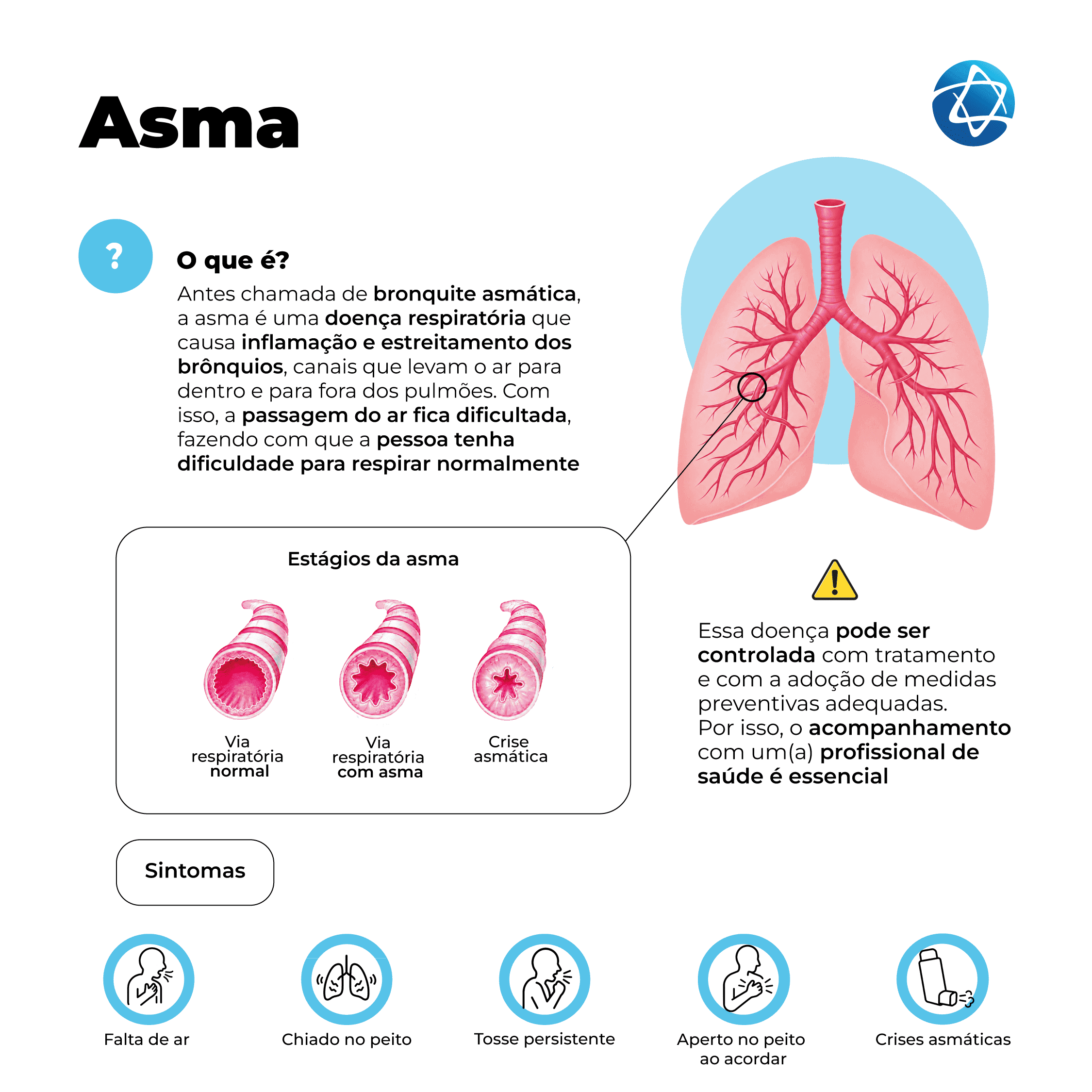 Infográfico sobre asma (bronquite asmática). Explica a causa da inflamação e ilustra o estreitamento dos brônquios, condição a qual dificulta a passagem do ar. Mostra a via respiratória normal, a via respiratória com asma e a crise asmática, além dos sintomas: falta de ar, chiado no peito, tosse persistente, aperto no peito ao acordar e crises asmáticas. Infográfico sobre asma (bronquite asmática). Explica a causa da inflamação e ilustra o estreitamento dos brônquios, condição a qual dificulta a passagem do ar. Mostra a via respiratória normal, a via respiratória com asma e a crise asmática, além dos sintomas: falta de ar, chiado no peito, tosse persistente, aperto no peito ao acordar e crises asmáticas.