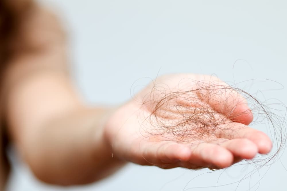 Uma pessoa recolhe uma grande quantidade de fios de cabelo com a mão.