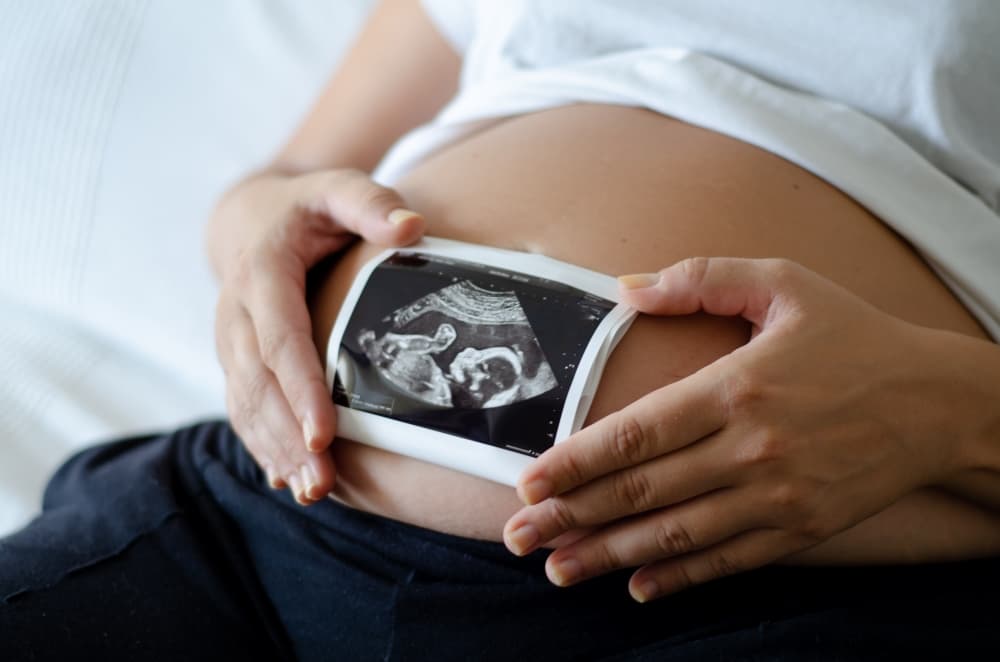Uma mãe com uma imagem do ultrassom de 9 semanas de gestação