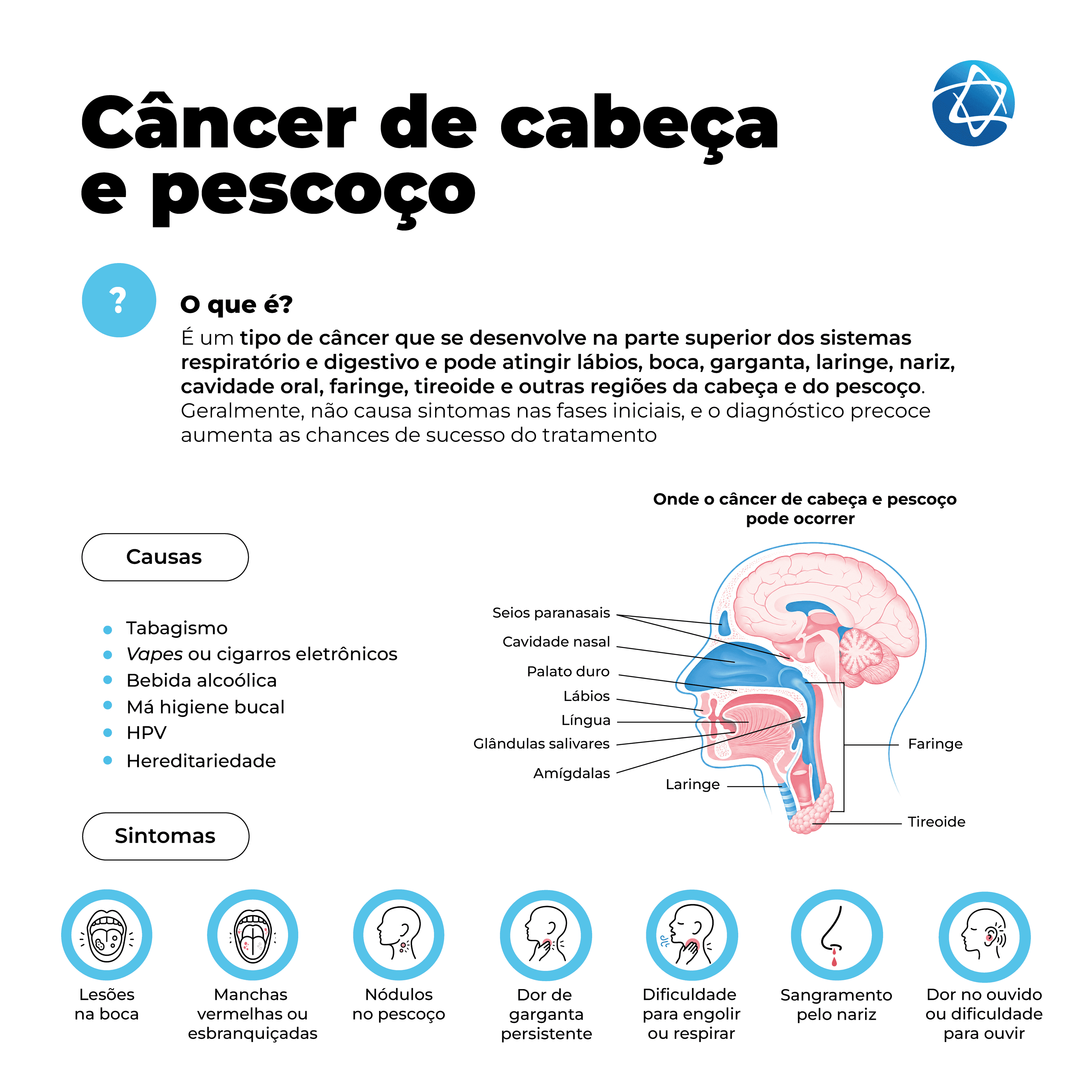 Infográfico sobre câncer de cabeça e pescoço, mostrando causas e sintomas. Ilustração anatômica lateral de cabeça e pescoço com indicação de seios paranasais, cavidade nasal, palato, lábios, língua, glândulas salivares, amígdalas, faringe, laringe e tireoide. Ícones destacam sintomas como lesões na boca, manchas vermelhas ou esbranquiçadas, nódulos no pescoço, dor de garganta persistente, dificuldade para engolir ou respirar, sangramento pelo nariz e dor no ouvido ou dificuldade para ouvir. Infográfico sobre câncer de cabeça e pescoço, mostrando causas e sintomas. Ilustração anatômica lateral de cabeça e pescoço com indicação de seios paranasais, cavidade nasal, palato, lábios, língua, glândulas salivares, amígdalas, faringe, laringe e tireoide. Ícones destacam sintomas como lesões na boca, manchas vermelhas ou esbranquiçadas, nódulos no pescoço, dor de garganta persistente, dificuldade para engolir ou respirar, sangramento pelo nariz e dor no ouvido ou dificuldade para ouvir.