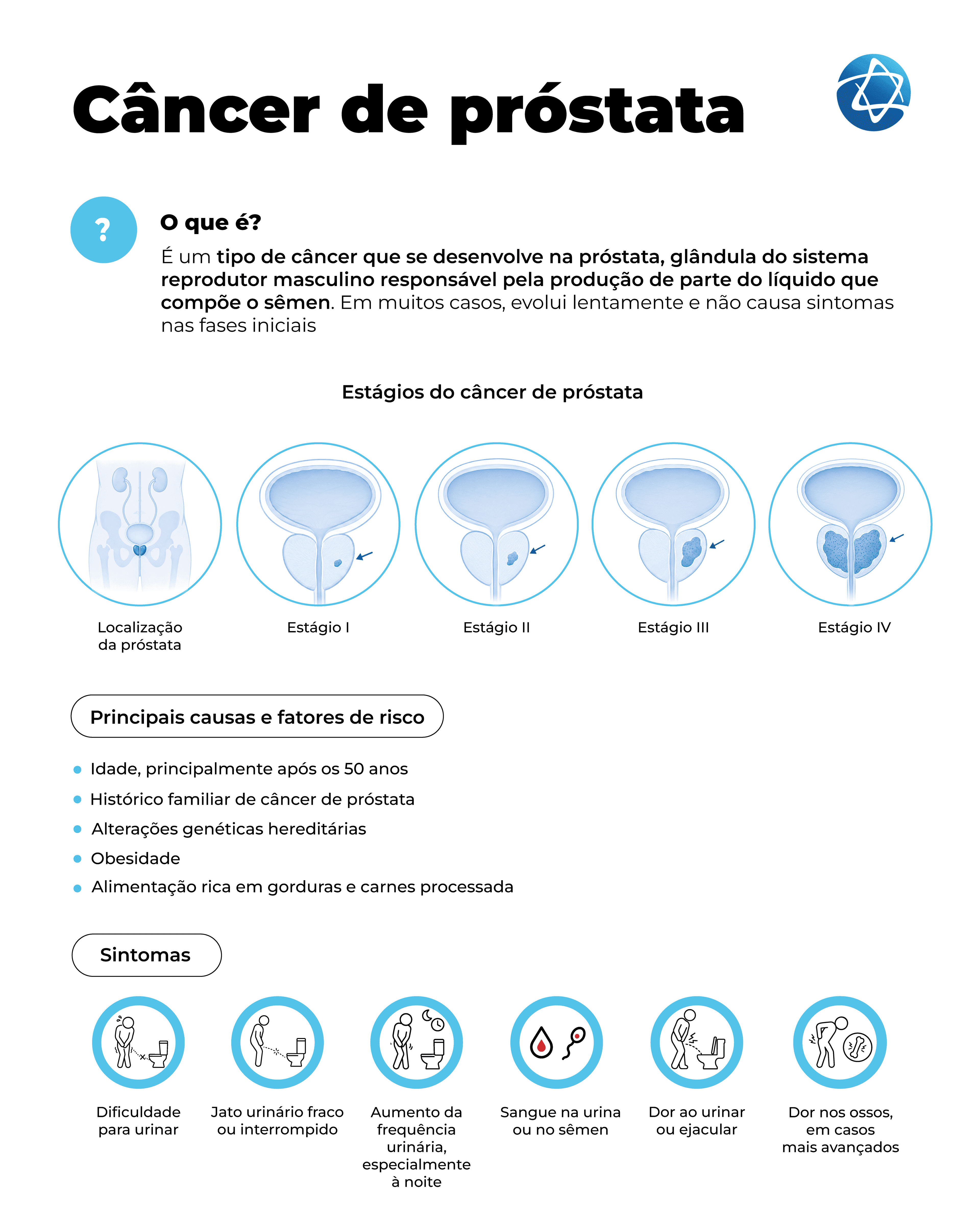 Infográfico sobre câncer de próstata, que se desenvolve na glândula responsável por produzir parte do líquido seminal. Apresenta os estágios da doença, fatores de risco como idade acima de 50 anos, histórico familiar, alterações genéticas, obesidade e alimentação inadequada. Destaca sintomas como dificuldade para urinar, jato fraco, aumento da frequência urinária, sangue na urina ou sêmen, dor ao urinar ou ejacular e dor óssea em casos avançados. Infográfico sobre câncer de próstata, que se desenvolve na glândula responsável por produzir parte do líquido seminal. Apresenta os estágios da doença, fatores de risco como idade acima de 50 anos, histórico familiar, alterações genéticas, obesidade e alimentação inadequada. Destaca sintomas como dificuldade para urinar, jato fraco, aumento da frequência urinária, sangue na urina ou sêmen, dor ao urinar ou ejacular e dor óssea em casos avançados.