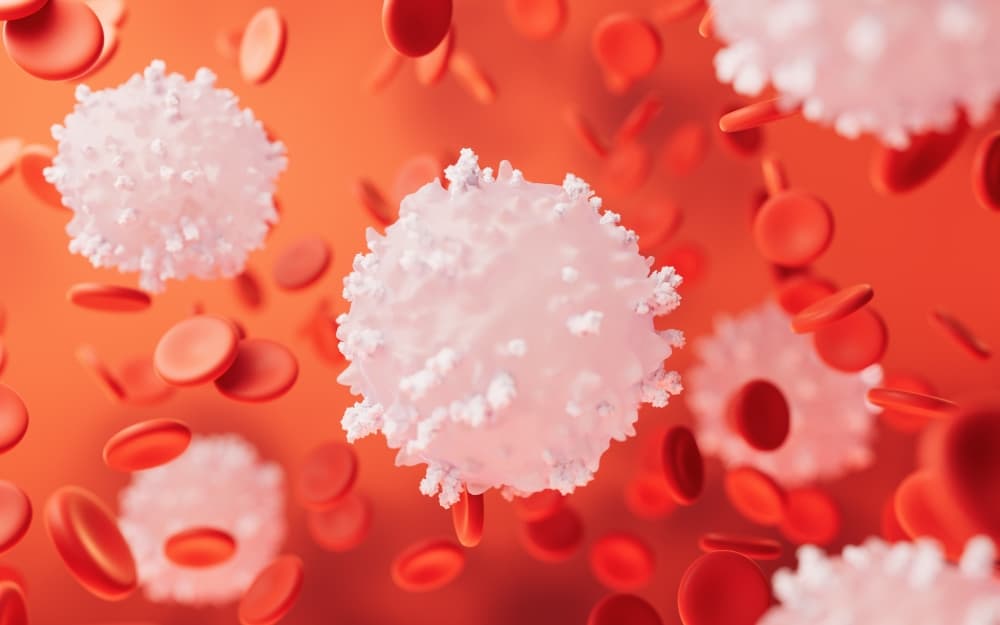 A mielodisplasia, também chamada de síndrome mielodisplásica, é um grupo de doenças que afeta a medula óssea, estrutura responsável pela produção das células do sangue
