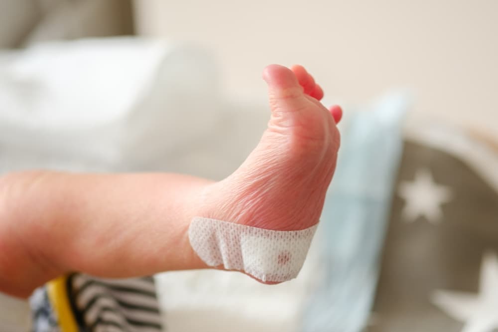 Newborn,Blood,Spot,Or,Heel,Prick,Test,(the,Guthrie,Test).