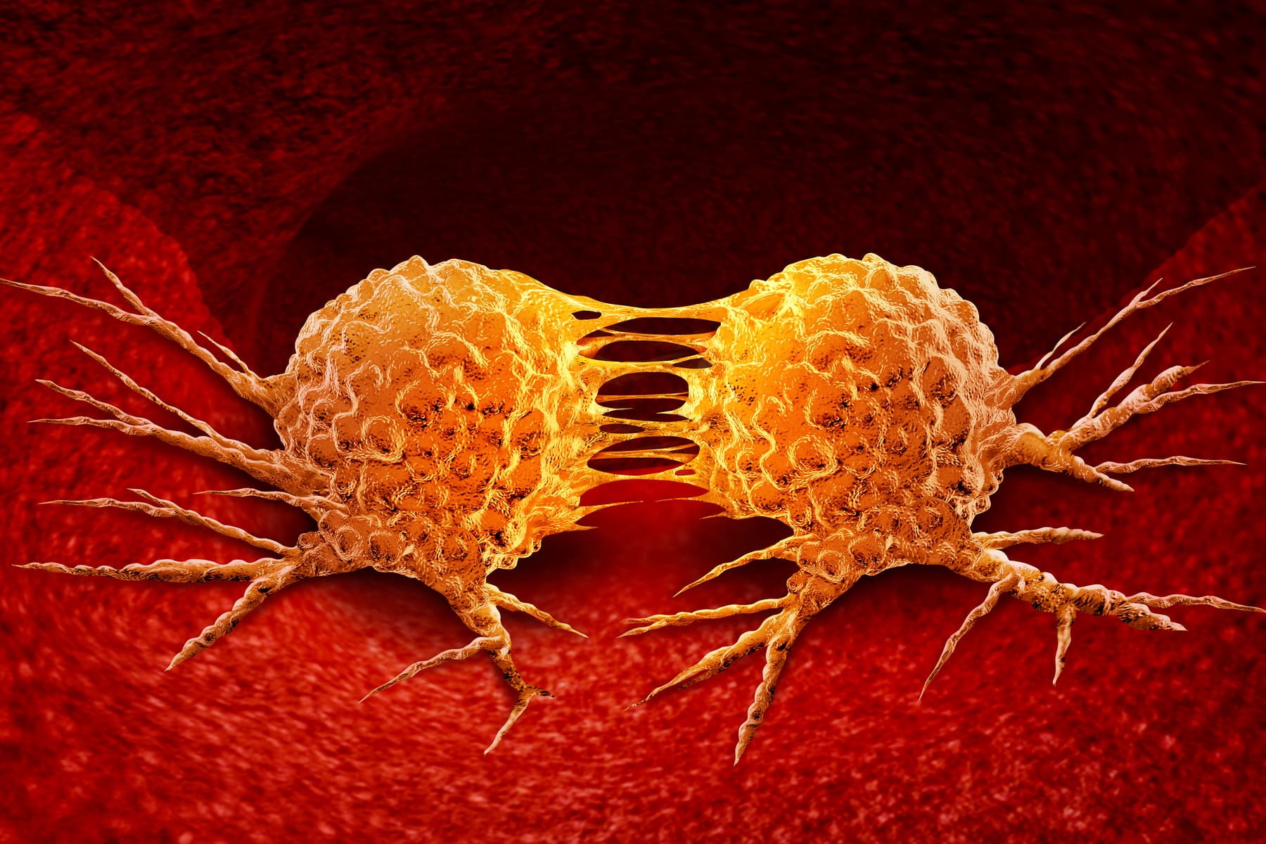cancer_metastase