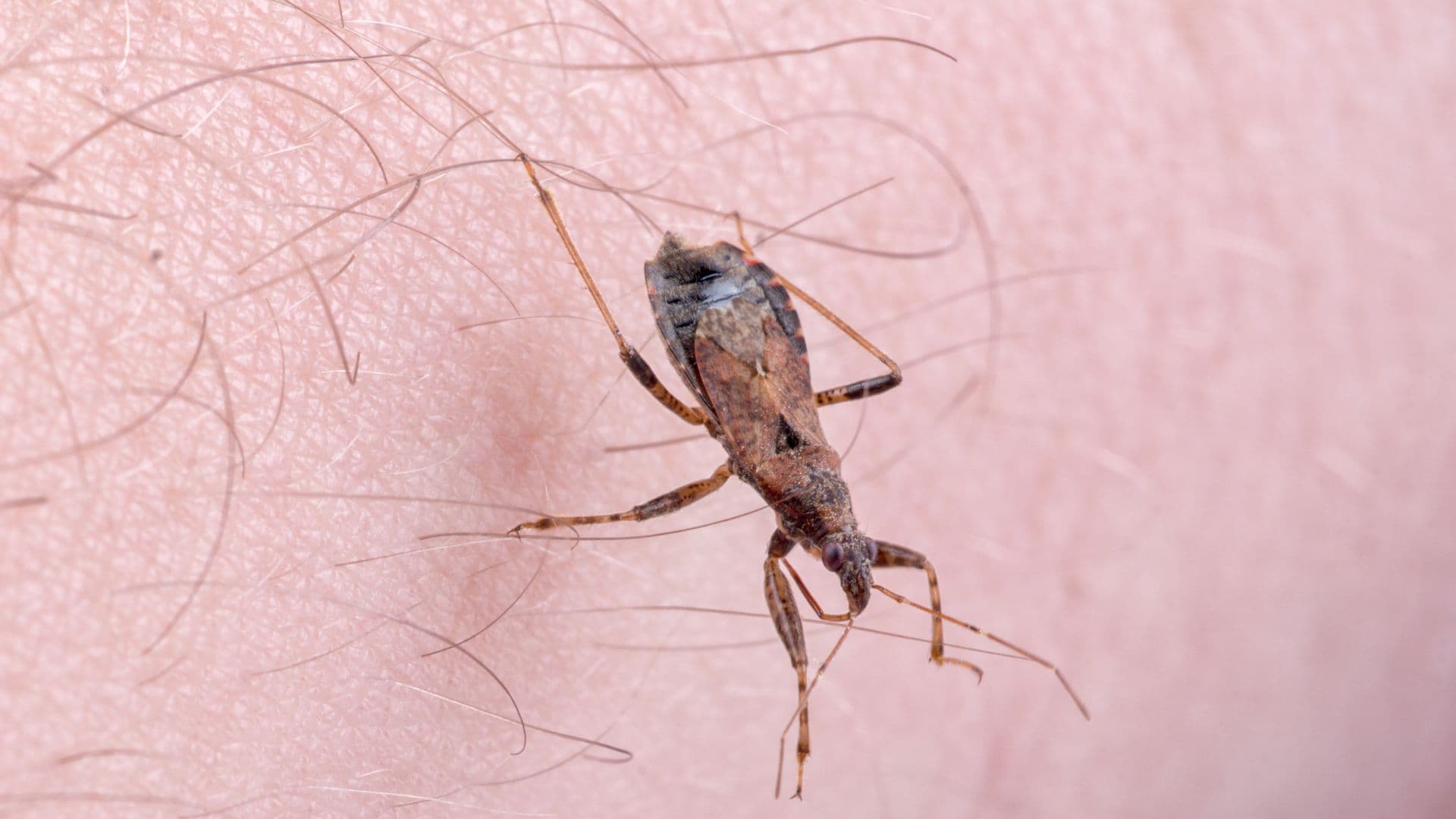 doenca de chagas