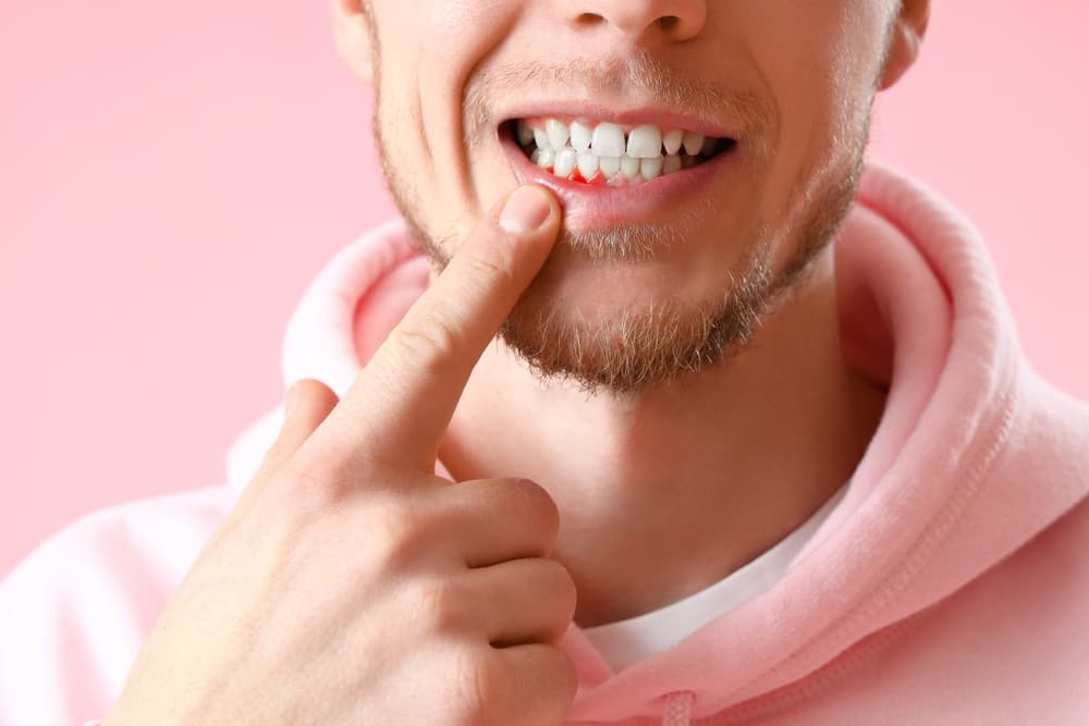 Man,With,Gum,Inflammation,On,Pink,Background,,Closeup