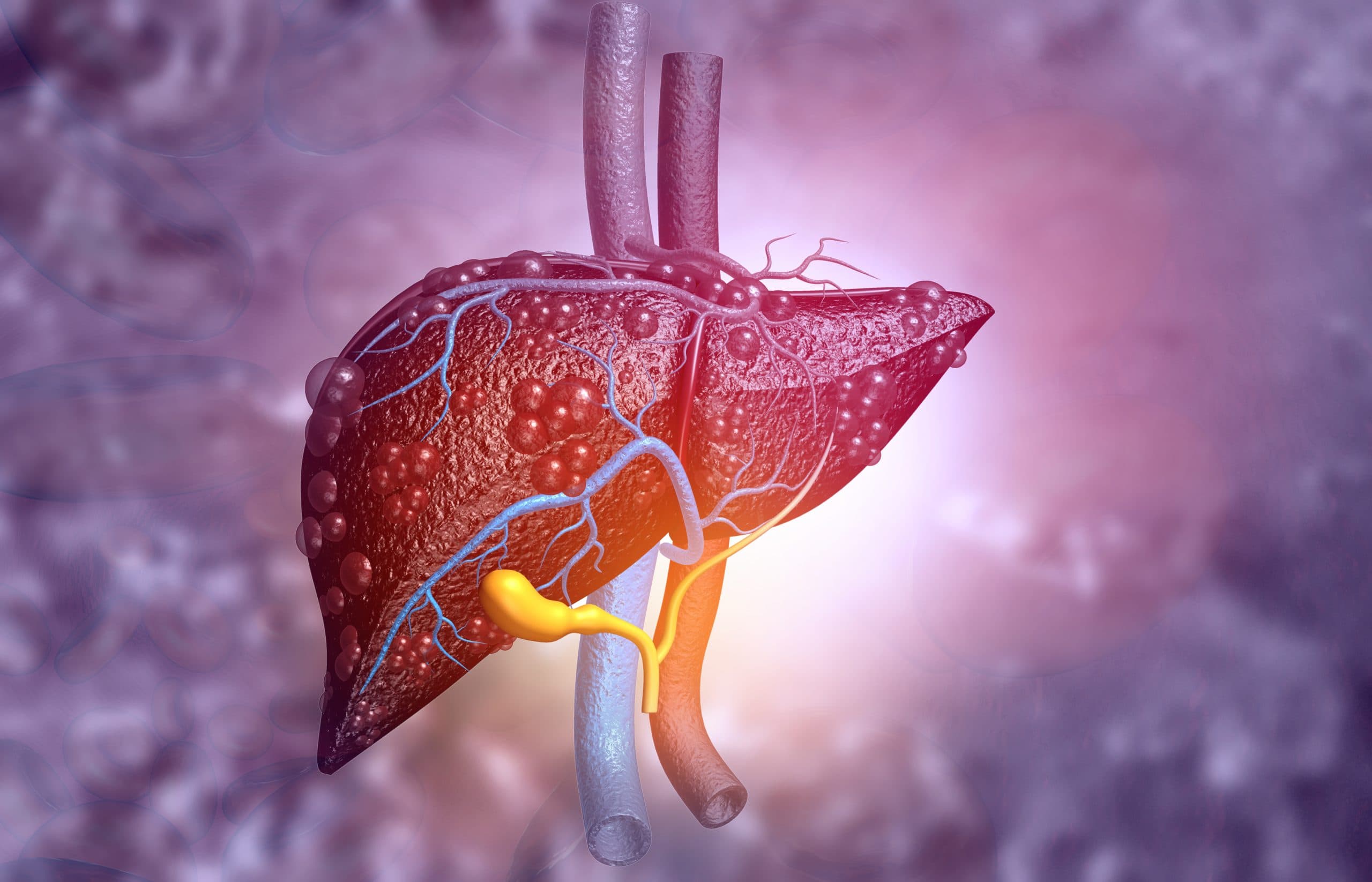 3d,Illustration,Of,Abstract,Medical,Background,With,Diseased,Liver