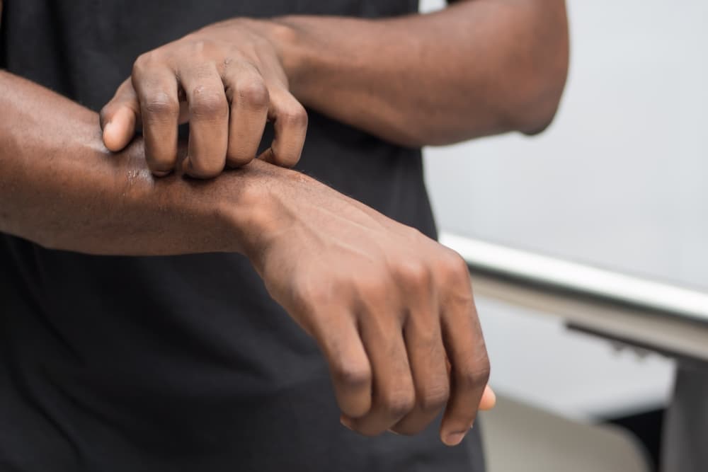 A dermatite atópica pode ser desencadeada por fatores ambientais. Conhecer esses elementos é essencial para o controle da condição.