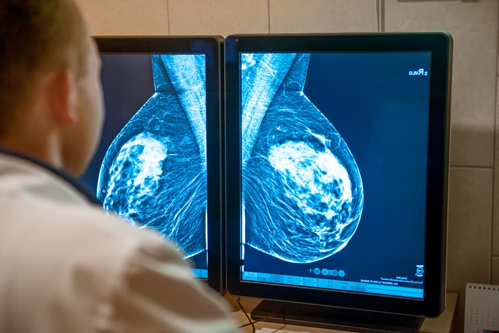 Profissional de saúde analisando exame de imagem - mamografria